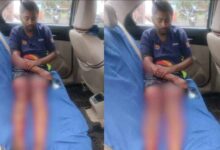 चॉइस सेंटर संचालक पर जानलेवा हमला, पुरानी रंजिश बनी वजह