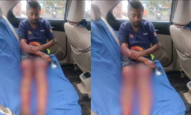 चॉइस सेंटर संचालक पर जानलेवा हमला, पुरानी रंजिश बनी वजह