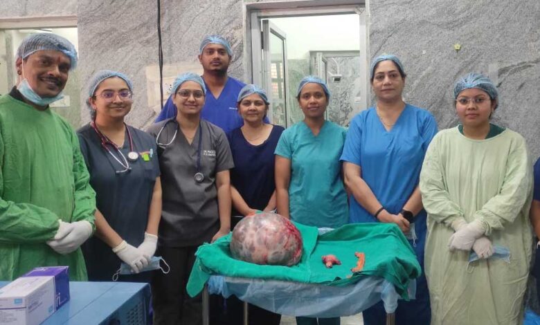 रायपुर : सिम्स में जटिल सर्जरी, 65 वर्षीय महिला के पेट से निकाला गया 10 किलो से अधिक वजन का ट्यूमर